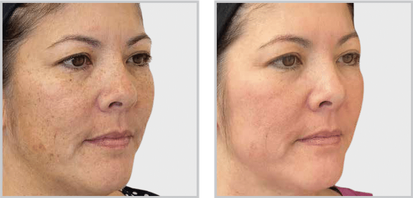  Olavita serum - Anita R. Albany, N